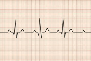 Image of an ECG of the heart.