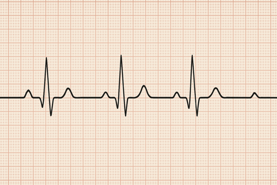 Image of an ECG of the heart.